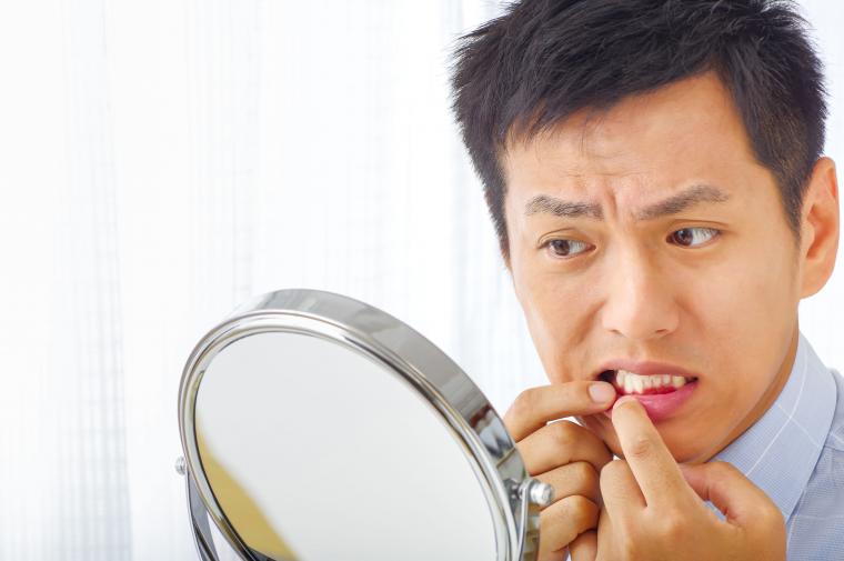 歯周病の特徴とは?毎日の習慣から始める予防方法