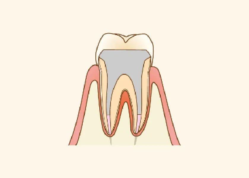 患部の確認と精密検査の実施