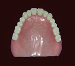 プラスチック義歯（保険適用）